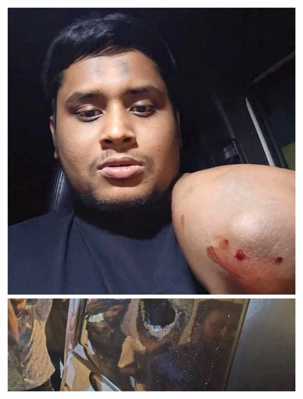 গাজীপুরের হাসনাত আব্দুল্লাহ গাড়িতে হামলা